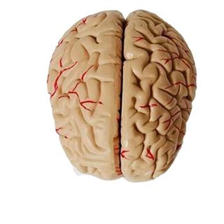 Cerebro con arterias desarmable,hi-res
