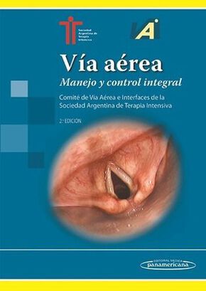 Libro Via Aerea, Manejo Y Control Integral 2ed.,hi-res