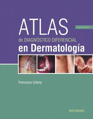 Libro Atlas De DiagnosticoDiferencial En Dermatologia 2ed.,hi-res